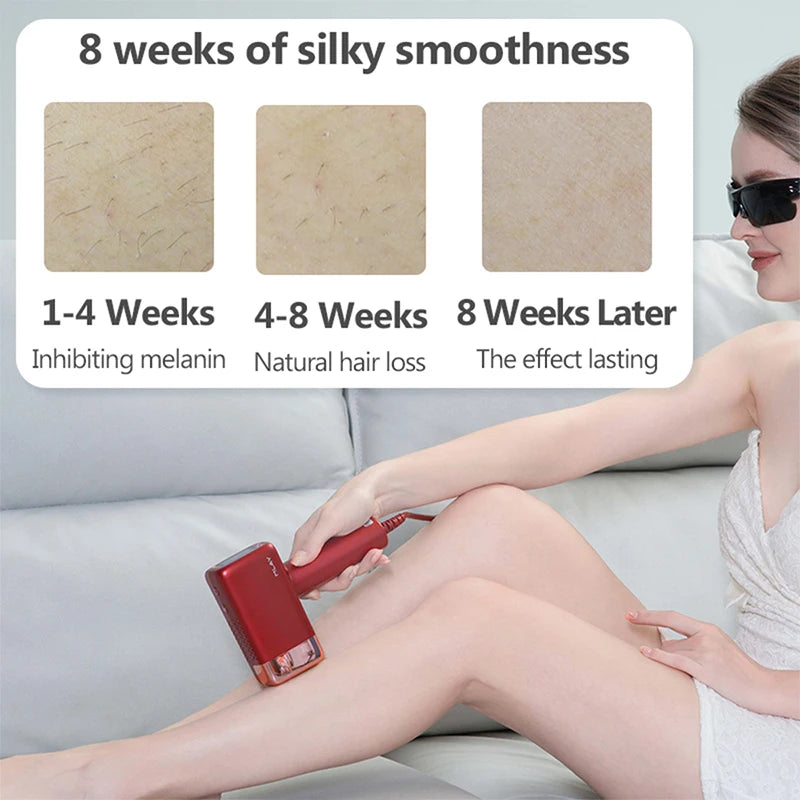 Mlay Lasor Hair Removal Machine